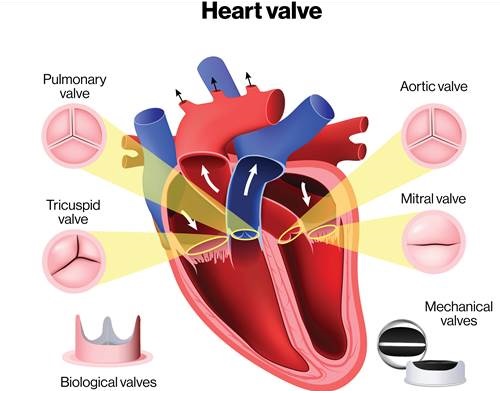 Inappropriate Anti-coagulation of Patients with a Mechanical Heart Valve
